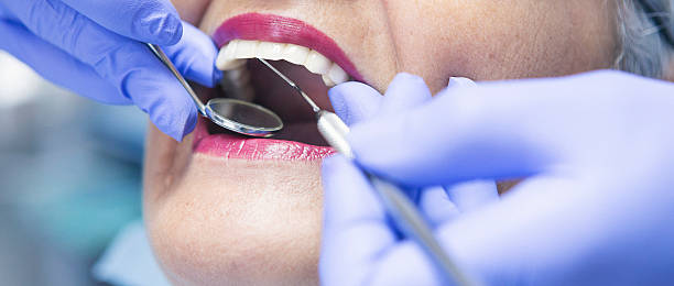 Best Emergency Broken Tooth Repair in Willowbrook, CA